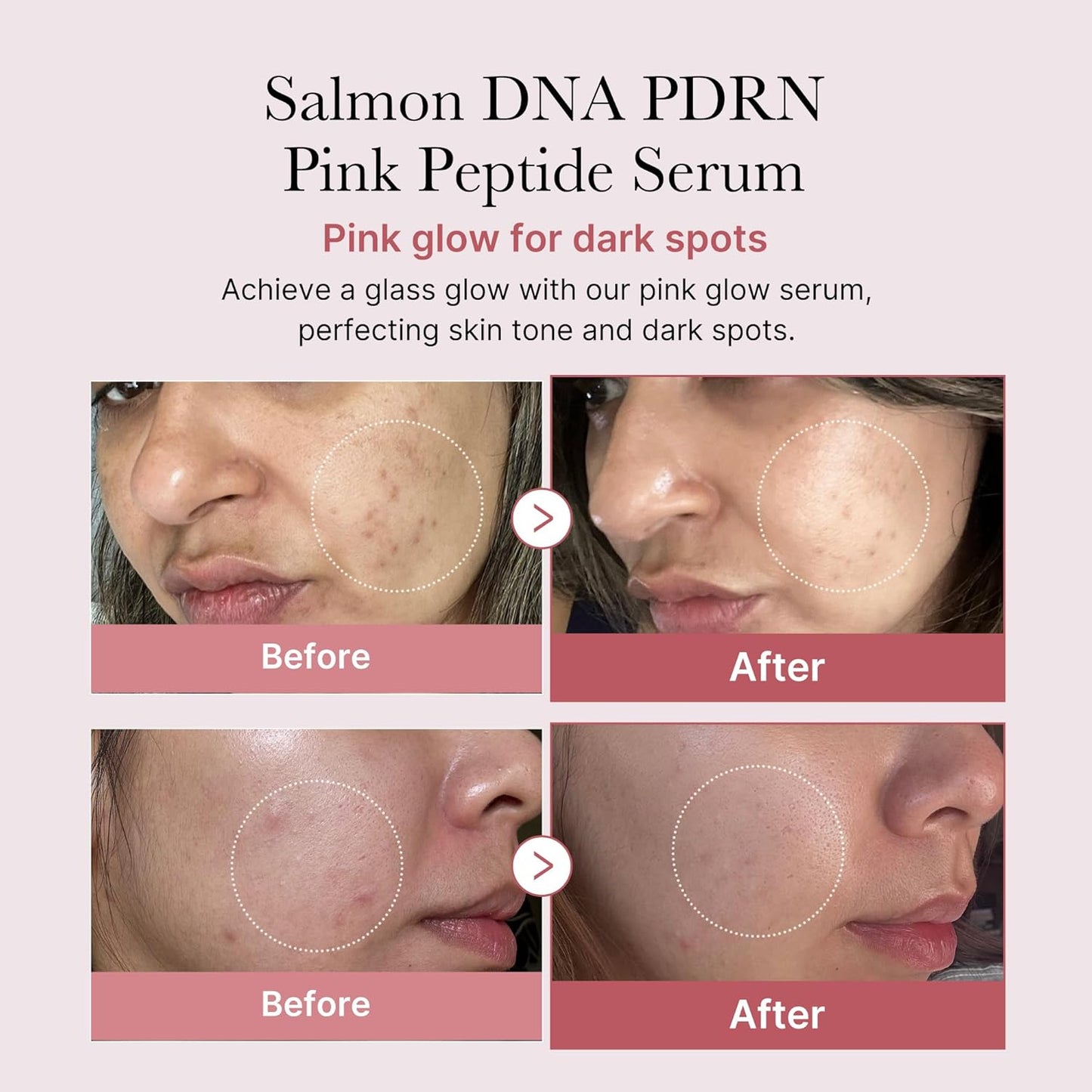 Radiant Glow Peptide Serum™