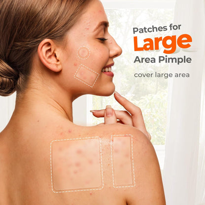 Pimple Patch Pro™ – Clear Skin Revolution