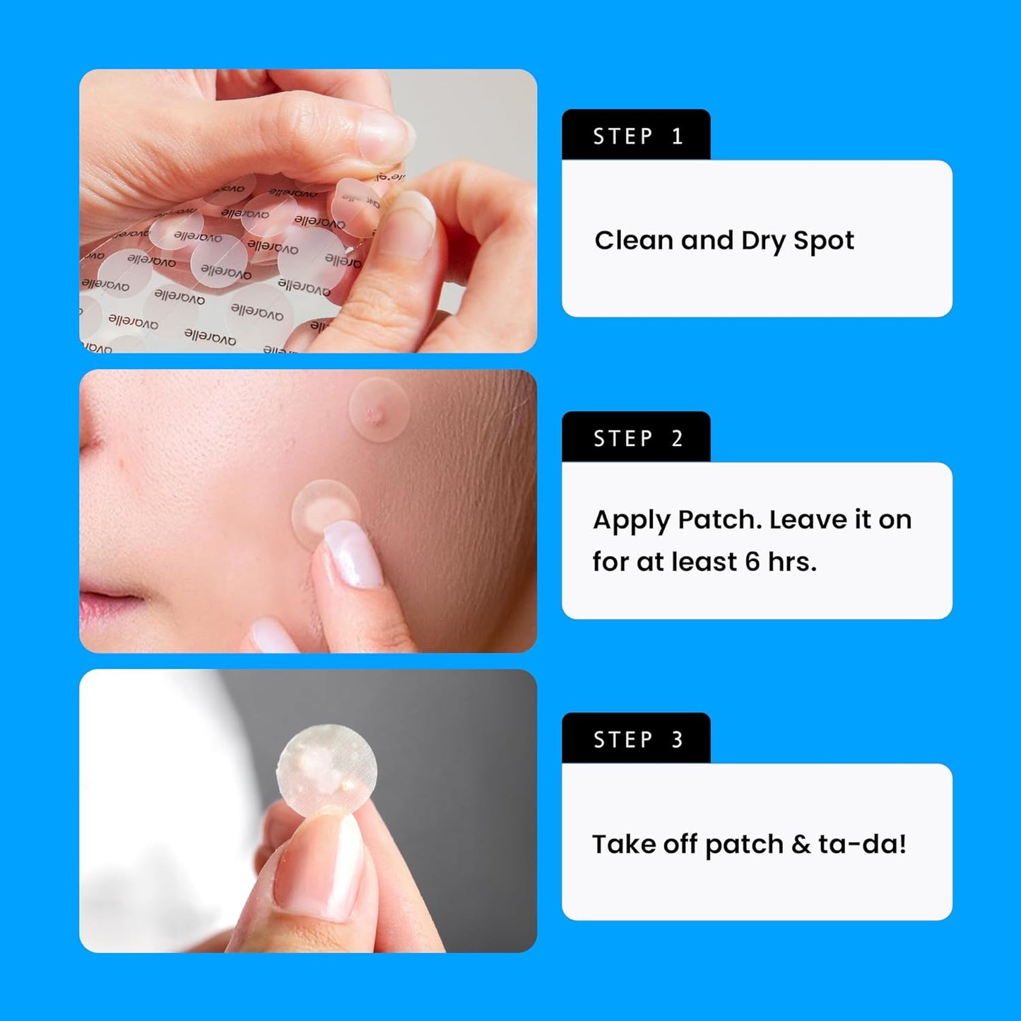 ClearSkin Acne Cover Patches™