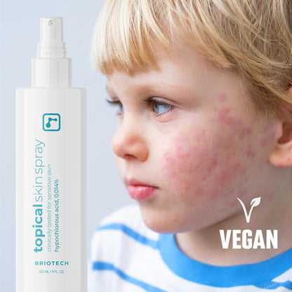 Soothing Skin Mist for Sensitive Skin™