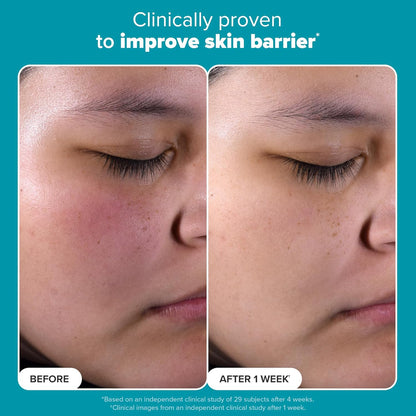 Skin Perfecting BHA Exfoliant™